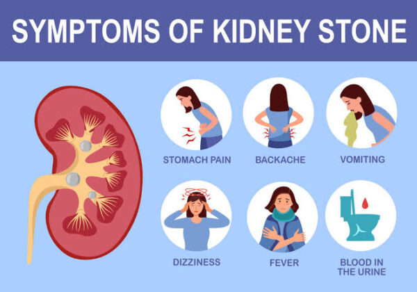 Kidney Stone Solution - Image 2